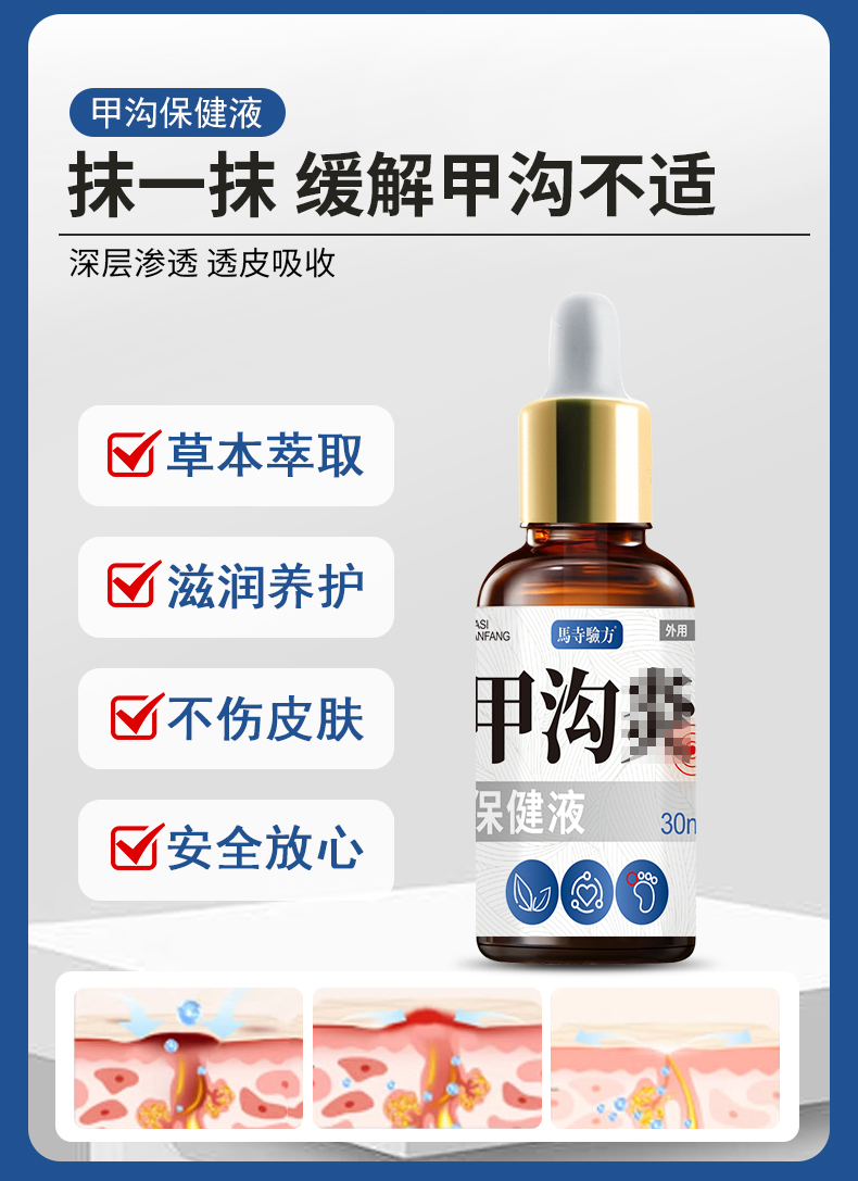 抹一抹，緩解甲溝不適